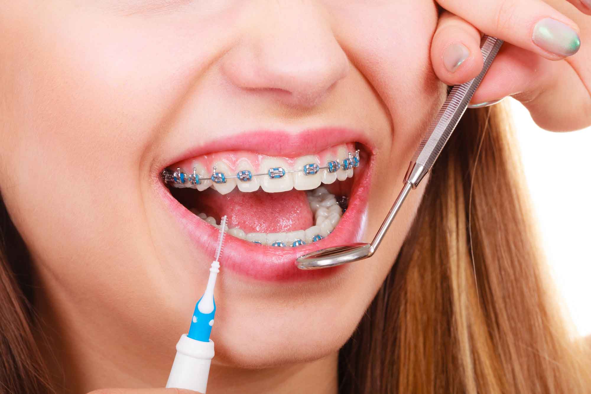 woman needing dental cleanings and orthodontics