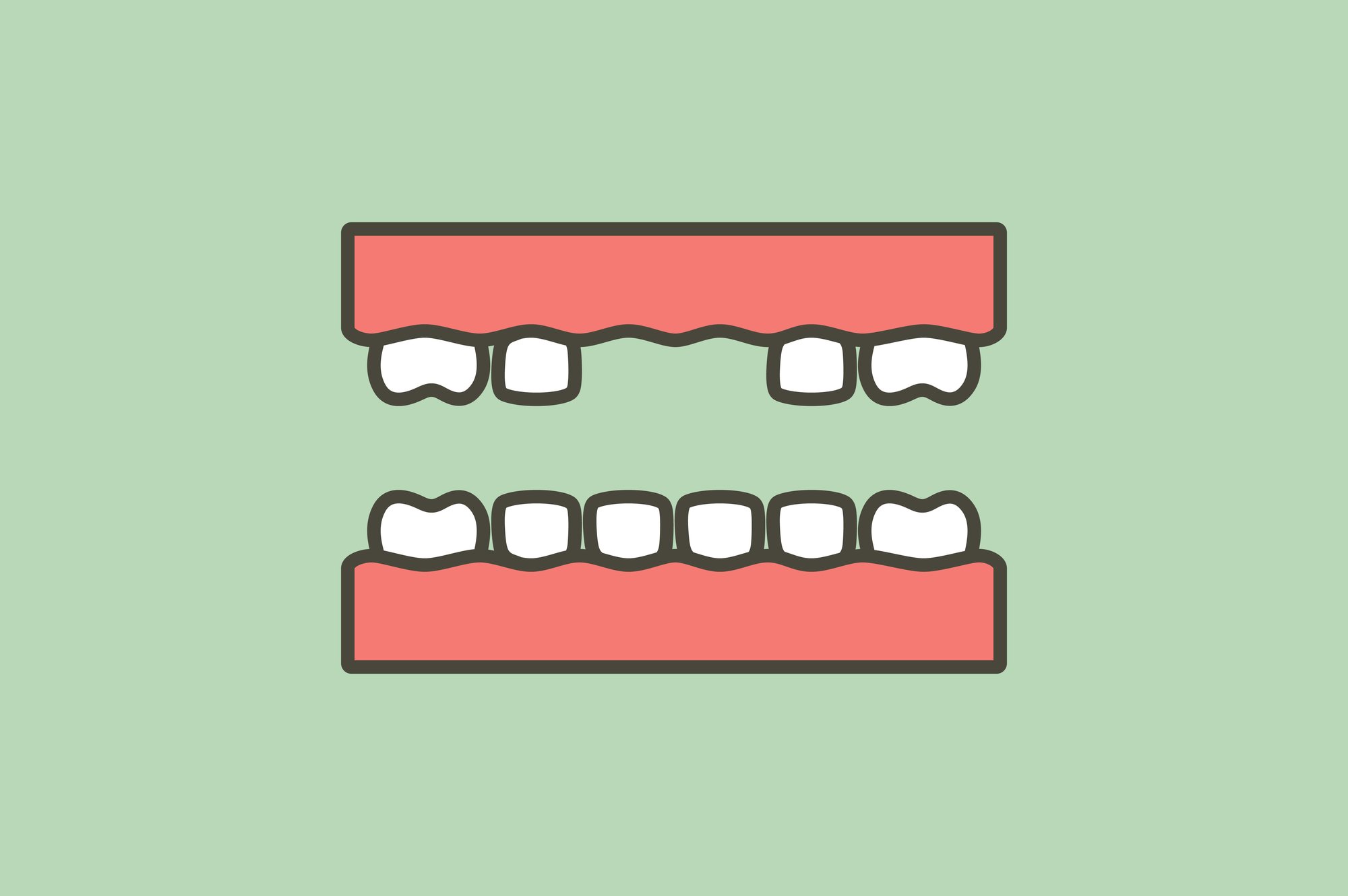 illustration of missing front teeth