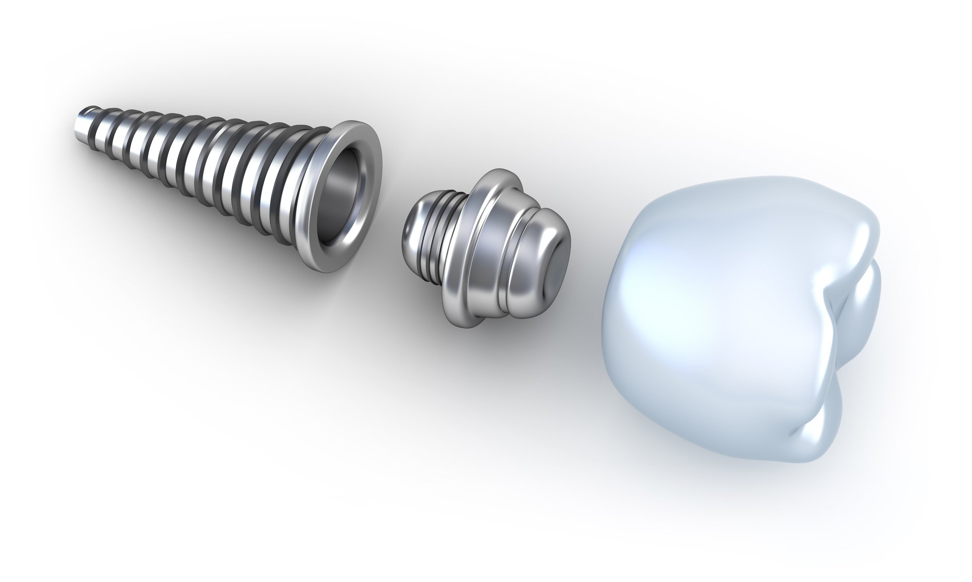 parts of dental implant