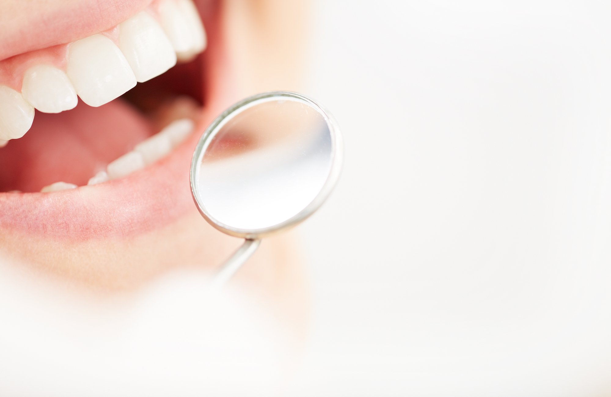 close up of mouth and dental mirror