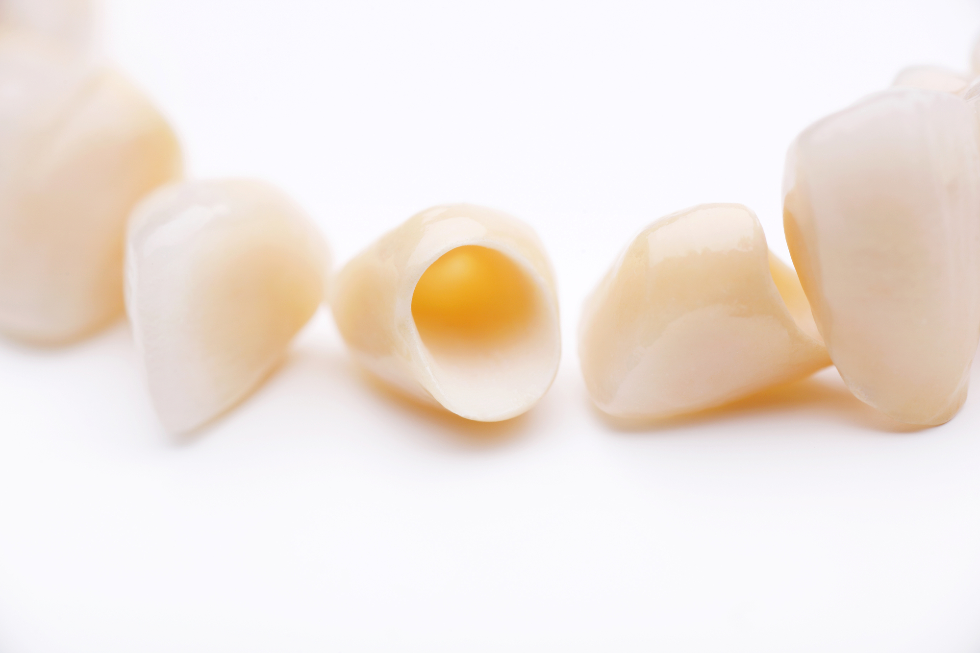 Close-up image of crowns for teeth in Coffs Harbour, NSW
