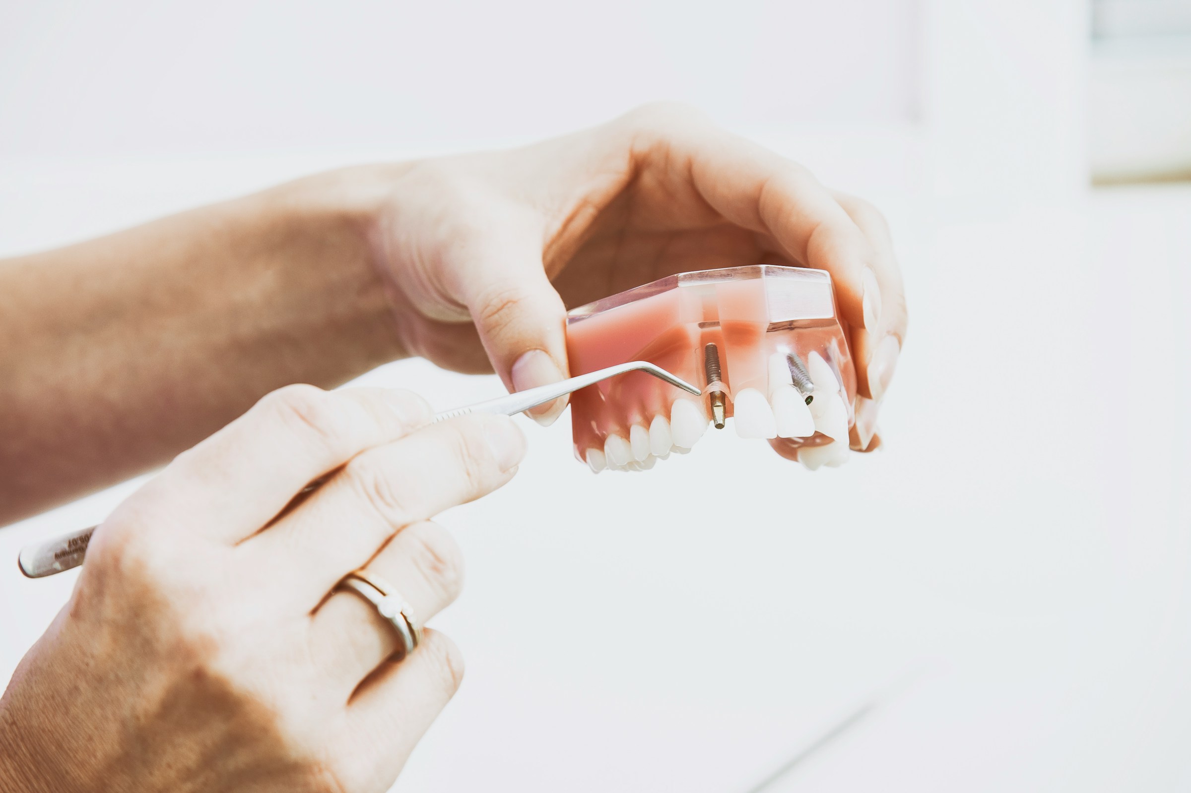 hand holding model of teeth, placing a dental implant